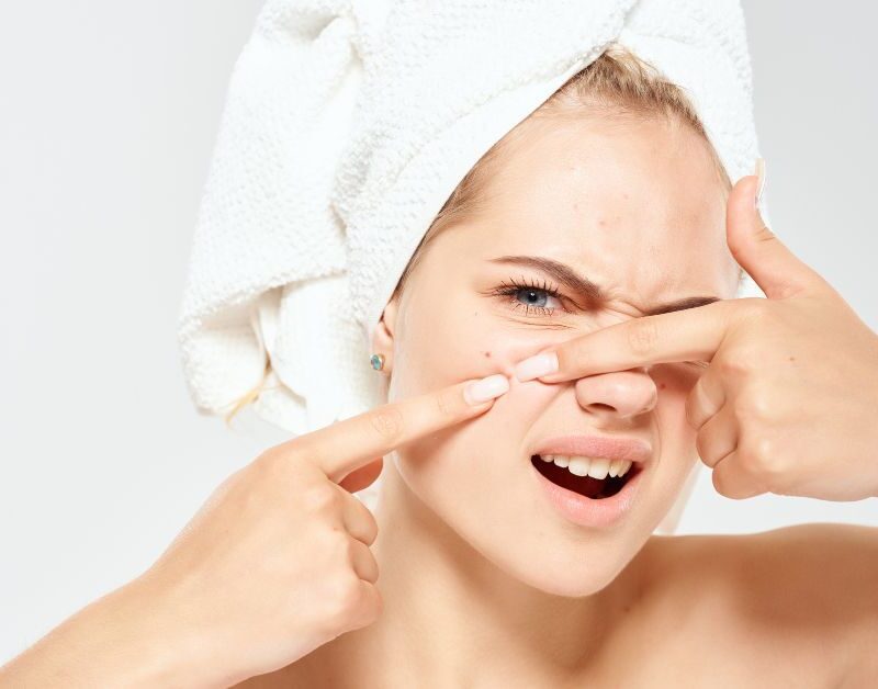 wat te doen tegen acne