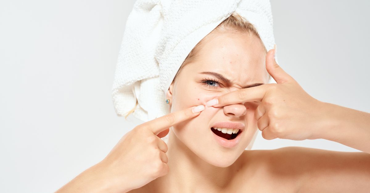 wat te doen tegen acne